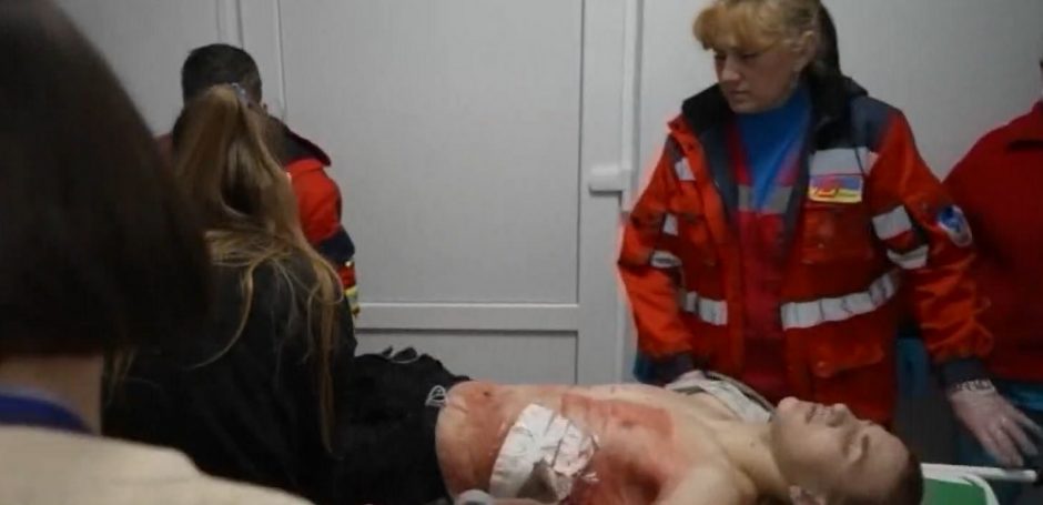 Ukrainoje dirbę medikai – apie sunkiai sužeistus žmones: tokių dalykų nebuvo tekę matyti