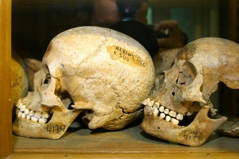 Kraupu: Šalčininkuose rasti galimai žmogaus kaulai ir kaukolės