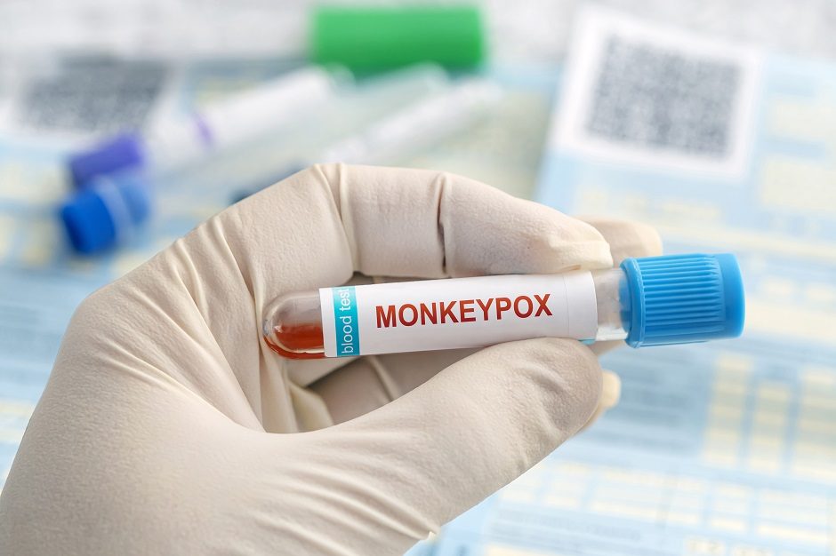 Lietuvą pasiekė vakcinos nuo beždžionių raupų