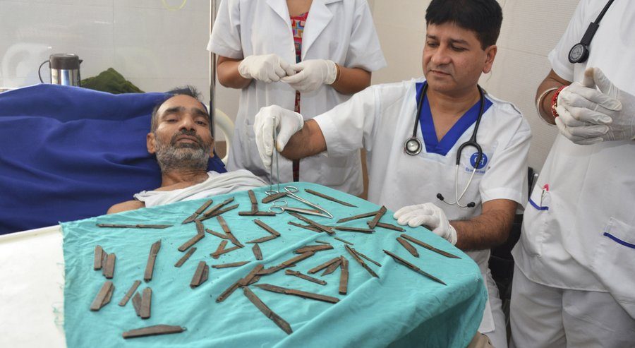 Indijoje 40 peilių prarijęs vyras kaltina jį suviliojusias dvasias