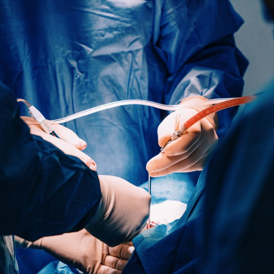 Kauno klinikose atlikta 600-oji inkstų transplantacija