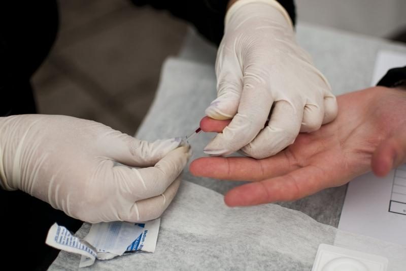 Dvigubai daugiau pradėtų gydyti ŽIV pacientų, tačiau yra problemų