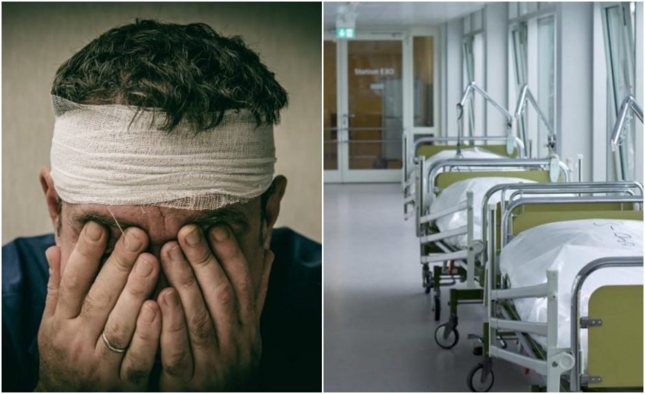Panevėžio ligoninėje atsidūrė sunkią galvos traumą patyręs vyras