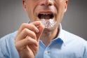 Nelegalu: įstaigos, siūlančios paslaugas namuose, rekomenduoja pacientams patiems nuimti dantų atspaudus nuo žandikaulių.