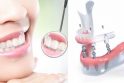 Pažangu: „Ant dantų implantų pritvirtintas neišimamas protezas suteikia galimybę jaustis tarsi su savais dantimis“, – teigia gydytoja odontologė ortopedė A.Šidlienė.