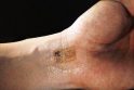 „Tatuiruotės“ mikroschema stebės pacientų gyvybines funkcijas