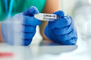Per parą šalyje – 161 naujas koronaviruso atvejis, mirė vienas žmogus