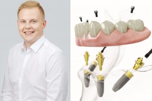 „Šypsenos akademijos“ burnos chirurgas apie efektyvų metodą: dantis atkūrėme per dešimt valandų
