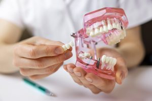 Kai, ruošiantis implantuoti dantį, tenka priauginti kaulo