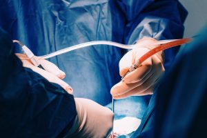 Kauno klinikose atlikta 600-oji inkstų transplantacija