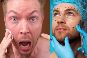 Kauno plastikos chirurgas, dailinęs recidyvisto nosį, tapo operacija nepatenkinto paciento įkaitu