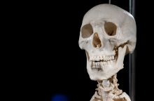 Kupiškio rajone aptikta žmogaus kaulų