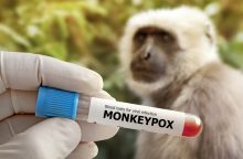 Vakcinų nuo beždžionių raupų – per mažai: kai kurie skiepytis skrenda svetur