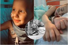 Mažasis Adamas kovoja su vėžiu: viltis yra, bet tėvams neužtenka pinigų