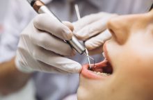 Odontologai pataria neišmesti ištraukto ar iškritusio danties: tam yra svarbi priežastis